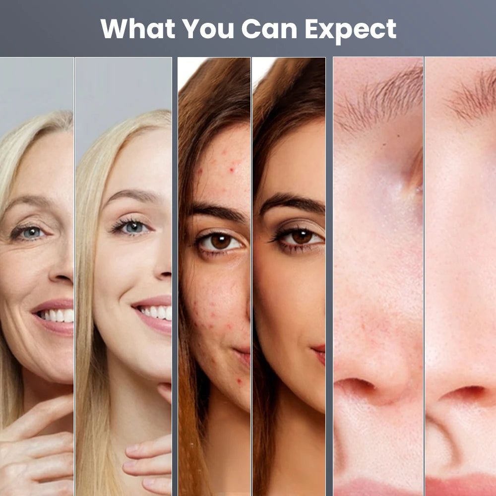 3 In 1 Hydro Dermabrasion Machine Deep Cleansing Facial Spa Microdermabrasion for Dead Skin Removal