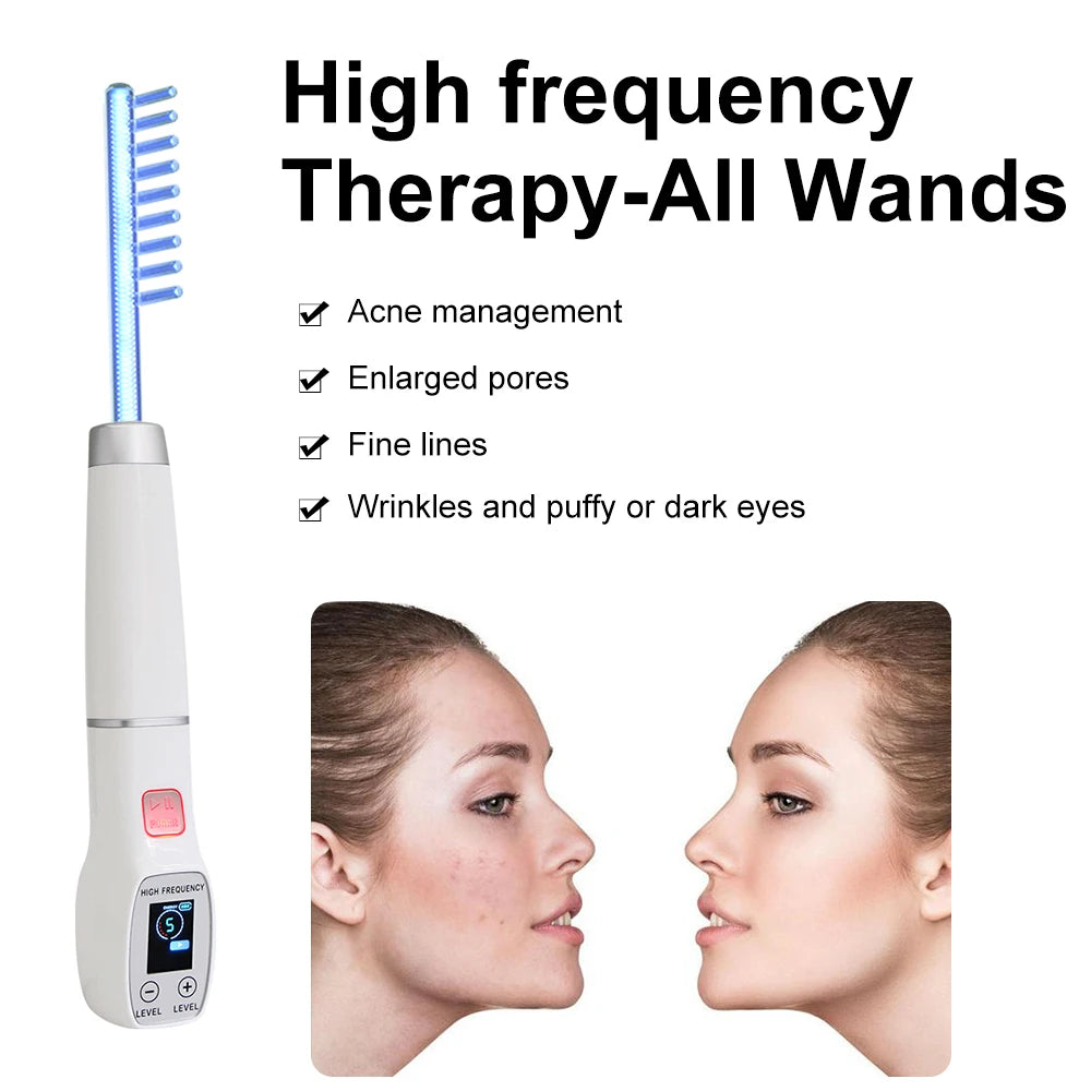 YUET WIN High Frequency Electrode Wand Acne Spot Remover