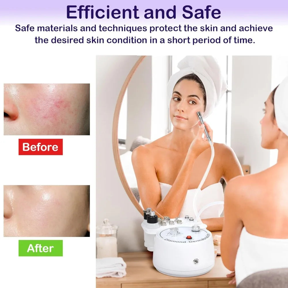 Hign-concerned 3 In 1 Diamond Microdermabrasion Machine