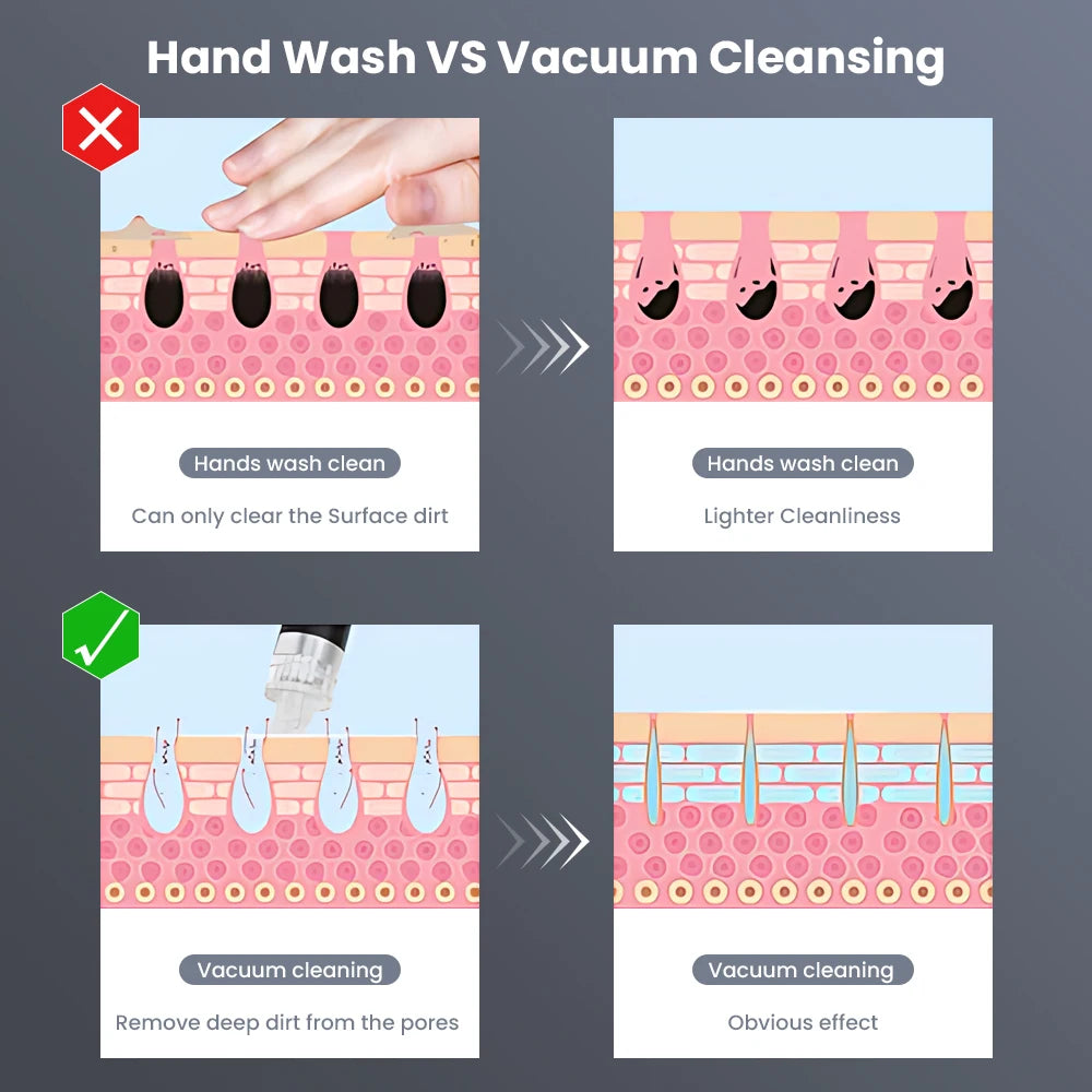 3 In 1 Hydro Dermabrasion Machine Deep Cleansing Facial Spa Microdermabrasion for Dead Skin Removal